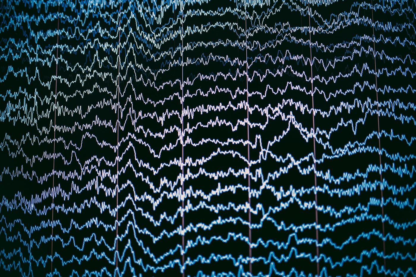 Client in a neurofeedback session watching live EEG feedback on a clinic monitor