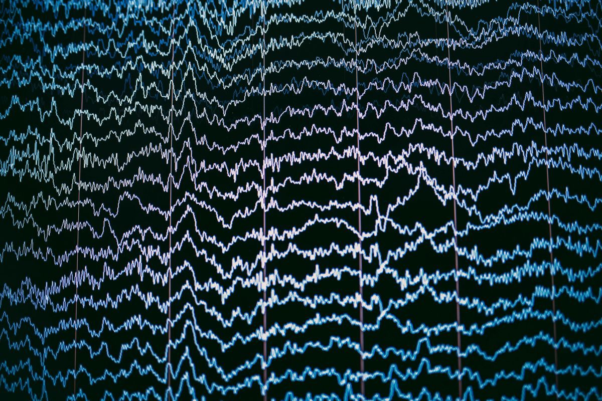 EEG brainwave traces displayed during analysis